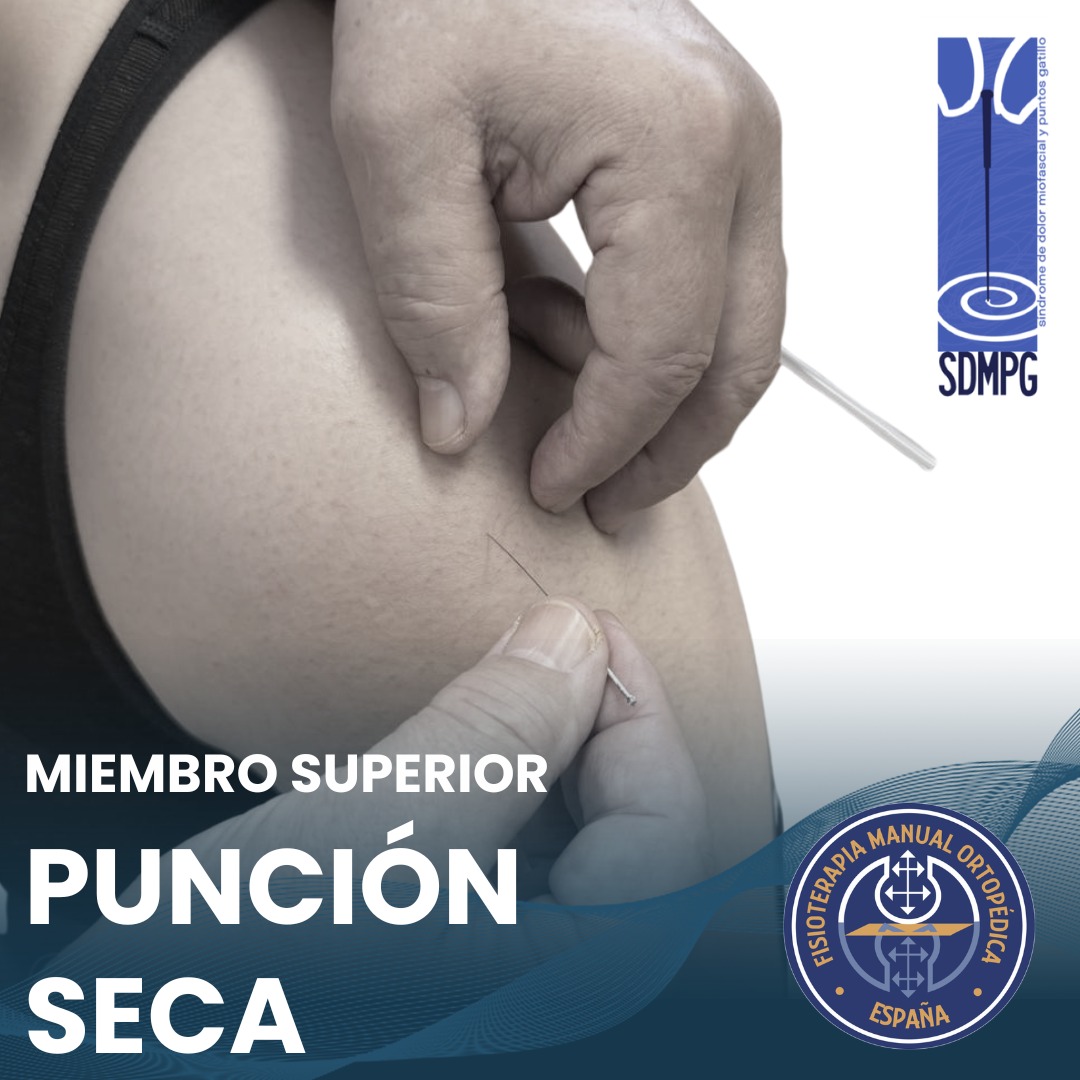 Curso Punción Seca Clínica y Puntos Gatillo en el Miembro Superior.
